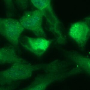 Human Recoverin Antibody (FITC Conjugate)