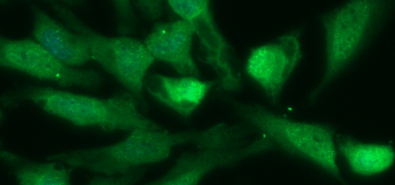 Human Recoverin Antibody (FITC Conjugate)