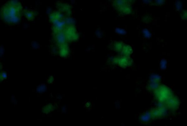 Human Fibroblast Growth Factor 21 (FGF-21) AssayLite Antibody (FITC Conjugate)