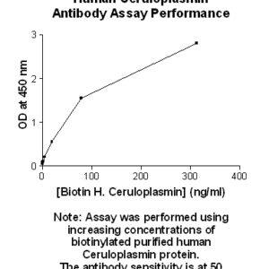 Human Ceruloplasmin (CP) Antibody