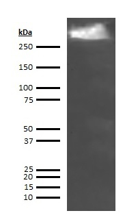 Human Thyroglobulin Antibody