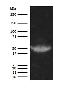 Human Factor VII  (Factor 7) Antibody