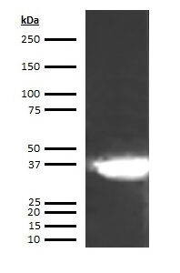 Human Apolipoprotein E4  (Apo E4) Antibody