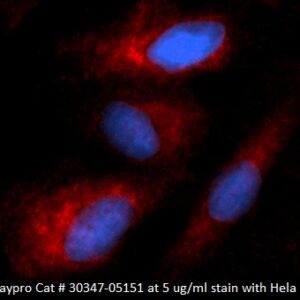 Human Cytokeratin-8 (CK-8) AssayLite Antibody (RPE Conjugate)