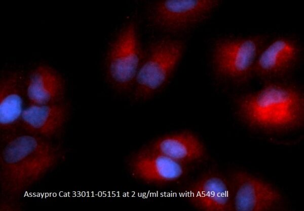 Human Glycyl-tRNA Synthetase (GARS) AssayLite Antibody (RPE Conjugate)