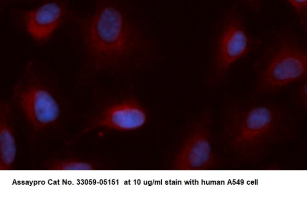 Human ACAD8 AssayLite Antibody (RPE Conjugate)