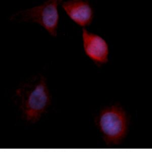 Human Annexin A3  (ANXA3) AssayLite Antibody (RPE Conjugate)