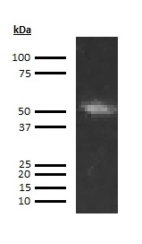Human Factor IX  (Factor 9) Monoclonal Antibody (Biotin Conjugate)