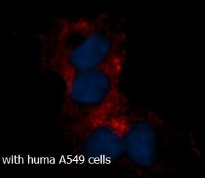 Human CtBP1 AssayLite RPE-Conjugated Antibody ICC Kit