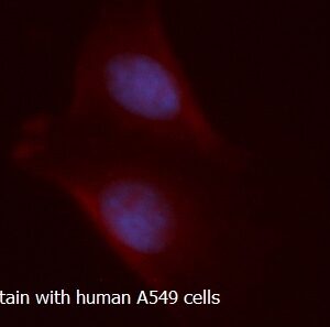 Human Alcohol Dehydrogenase 1C (ADH1C) AssayLite RPE-Conjugated Antibody ICC Kit