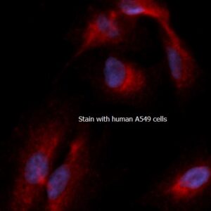 Human RAD6 AssayLite RPE-Conjugated Antibody ICC Kit