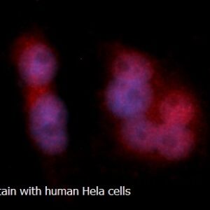 Human Acyl-coenzyme A Thioesterase 8 AssayLite RPE-Conjugated Antibody ICC Kit