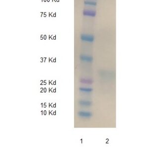 Biotinylated Human alpha-1-Microglobulin (A1M)