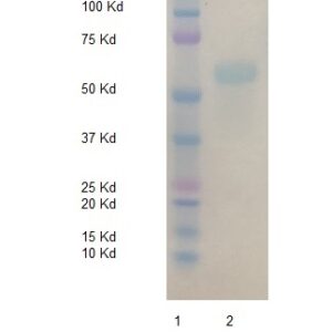 Biotinylated Human alpha-1-Antichymotrypsin (AACT)