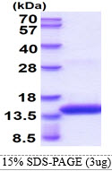 Dengue Virus 2 Envelope Protein (DENV)