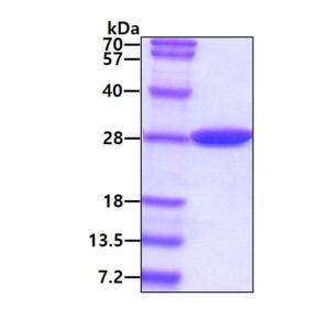 E. coli Carbonic Anhydrase 2 (CA2)