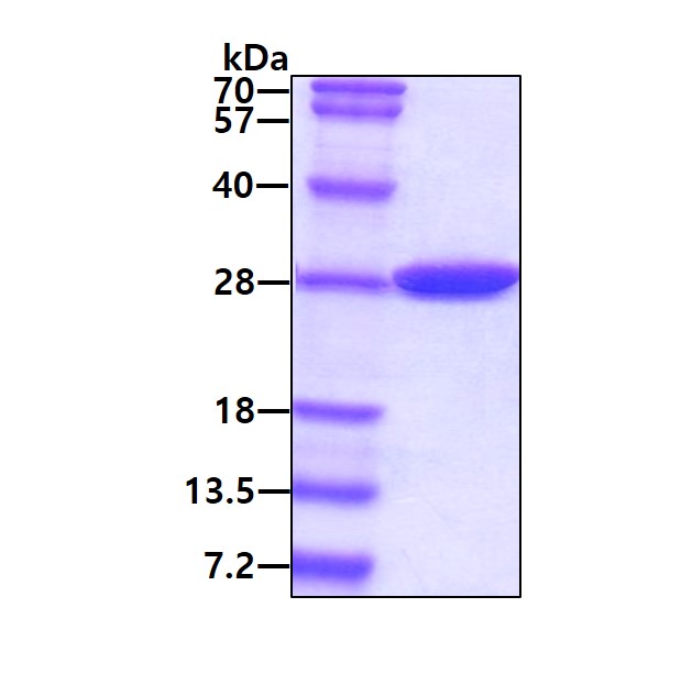 E. coli Carbonic Anhydrase 2 (CA2)