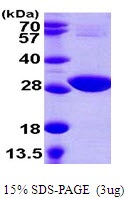E. coli CysH