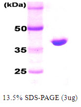 E. coli DnaK (1-384 aa)