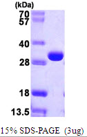 E. coli deoC