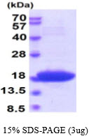 E. coli DnaK (508-638 aa)