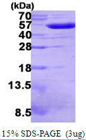E. coli GOR