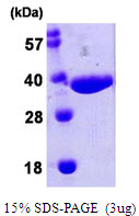 E. coli nanA