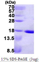 E. coli NDK