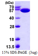 E. coli PYKF