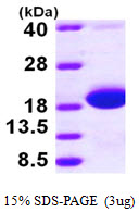E. coli SKP