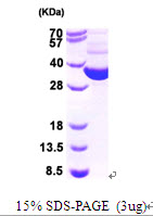 E. coli Thioredoxin Reductase (TRXB)