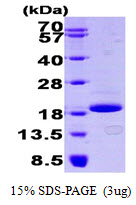 Human 4E-BP1