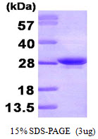 Human Apolipoprotein A-I (Apo A1)