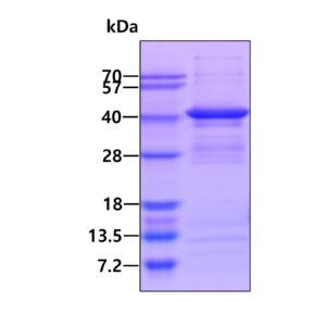 Human Arginase 1