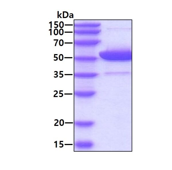 Human ALDH2