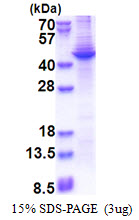 Human Apolipoprotein A-V (Apo A5)