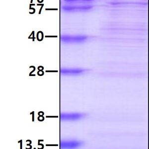 Human Apolipoprotein C-I (Apo C1)