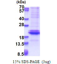 Human Adiponectin (ACRP30)