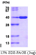 Human AKR1C3