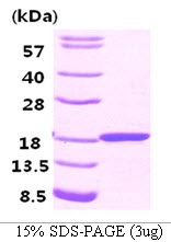 Human Fatty Acid-Binding Protein 3 (FABP3)