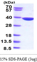 Human AKR1B10