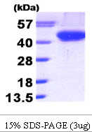Human Aurora Kinase B (AURKB)