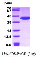 Human Annexin A5  (ANXA5)