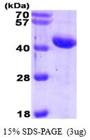 Human alpha-1-Antichymotrypsin (AACT)