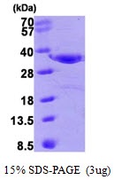 Human Annexin A4  (ANXA4)