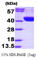 Human Aldolase A