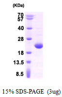 Human Adenine Phosphoribosyltransferase (APRT)