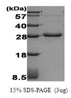 Human Adiponectin (ACRP30)