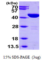 Human Aspartate Aminotransferase, Cytoplasmic (cAspAT, GOT1)