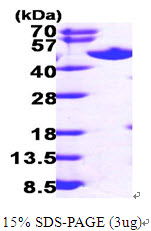 Human Adenosylhomocysteinase (AHCY)